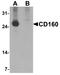 CD160 antigen antibody, TA326654, Origene, Western Blot image 