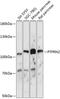 Protein Tyrosine Phosphatase Receptor Type N2 antibody, 15-722, ProSci, Western Blot image 