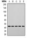 p38 antibody, orb338863, Biorbyt, Western Blot image 