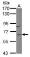 Zinc Finger Protein 282 antibody, LS-C155576, Lifespan Biosciences, Western Blot image 