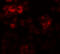 Dual specificity tyrosine-phosphorylation-regulated kinase 2 antibody, 6257, ProSci Inc, Immunofluorescence image 