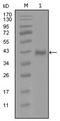 Androgen Receptor antibody, AM06279SU-N, Origene, Western Blot image 