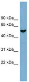 Family With Sequence Similarity 83 Member E antibody, TA344971, Origene, Western Blot image 