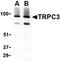 Transient Receptor Potential Cation Channel Subfamily C Member 3 antibody, orb74754, Biorbyt, Western Blot image 
