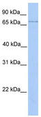 Lipase Maturation Factor 2 antibody, TA342054, Origene, Western Blot image 