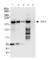 Enhancer Of MRNA Decapping 4 antibody, ab72408, Abcam, Western Blot image 