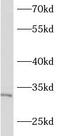 Ankyrin Repeat And SOCS Box Containing 17 antibody, FNab00622, FineTest, Western Blot image 
