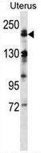 Mitogen-Activated Protein Kinase Kinase Kinase 4 antibody, AP52665PU-N, Origene, Western Blot image 