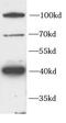 Frizzled Class Receptor 4 antibody, FNab10366, FineTest, Western Blot image 