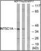 5'-Nucleotidase, Cytosolic IA antibody, orb178926, Biorbyt, Western Blot image 