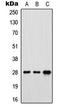 Folate Receptor Gamma antibody, LS-C352202, Lifespan Biosciences, Western Blot image 