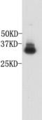 Glycophorin A (MNS Blood Group) antibody, TA323059, Origene, Western Blot image 
