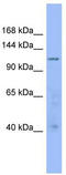 Rho GTPase Activating Protein 20 antibody, TA344759, Origene, Western Blot image 