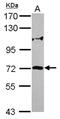 Zinc Finger Protein 571 antibody, NBP2-15176, Novus Biologicals, Western Blot image 