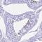 Prostate And Testis Expressed 4 antibody, PA5-61056, Invitrogen Antibodies, Immunohistochemistry paraffin image 