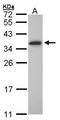 Oligodendrocyte Transcription Factor 1 antibody, GTX104823, GeneTex, Western Blot image 