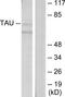 PHF-tau antibody, TA312272, Origene, Western Blot image 
