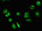 Vacuolar Protein Sorting 4 Homolog B antibody, LS-C680004, Lifespan Biosciences, Immunofluorescence image 