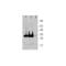Linker For Activation Of T Cells antibody, TA320411, Origene, Western Blot image 