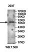 Zinc Finger Protein 449 antibody, orb78116, Biorbyt, Western Blot image 