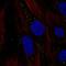 Chromosome 11 Open Reading Frame 91 antibody, HPA047064, Atlas Antibodies, Immunofluorescence image 