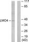 LIM Domain Only 4 antibody, TA314767, Origene, Western Blot image 