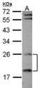 Regulator of G-protein signaling 4 antibody, orb74020, Biorbyt, Western Blot image 