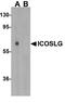 Inducible T Cell Costimulator Ligand antibody, A01965, Boster Biological Technology, Western Blot image 
