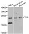 Von Hippel-Lindau Tumor Suppressor antibody, MBS125962, MyBioSource, Western Blot image 