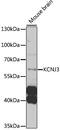 Potassium Voltage-Gated Channel Subfamily J Member 3 antibody, 14-435, ProSci, Western Blot image 