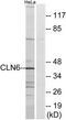 Ceroid-lipofuscinosis neuronal protein 6 antibody, TA315557, Origene, Western Blot image 