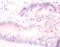 H2A Histone Family Member J antibody, A53292-100, Epigentek, Immunohistochemistry paraffin image 