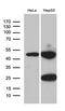Acyl-CoA Dehydrogenase Medium Chain antibody, LS-C796097, Lifespan Biosciences, Western Blot image 