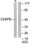 CCAAT Enhancer Binding Protein Beta antibody, TA312910, Origene, Western Blot image 