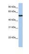 Solute Carrier Family 38 Member 9 antibody, orb325844, Biorbyt, Western Blot image 