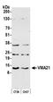 Vacuolar ATPase Assembly Factor VMA21 antibody, A305-701A-M, Bethyl Labs, Western Blot image 
