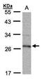 15-Hydroxyprostaglandin Dehydrogenase antibody, GTX104625, GeneTex, Western Blot image 