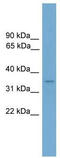 Protein Duxbl1 antibody, TA331436, Origene, Western Blot image 