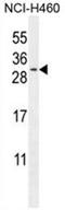 Testis Expressed 37 antibody, AP50604PU-N, Origene, Western Blot image 