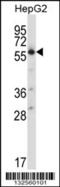 Solute Carrier Family 30 Member 1 antibody, 57-388, ProSci, Western Blot image 