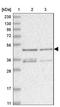 Zinc Finger Protein 641 antibody, NBP1-82022, Novus Biologicals, Western Blot image 