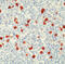 Ig lambda-1 chain C regions antibody, LS-C87852, Lifespan Biosciences, Immunohistochemistry paraffin image 