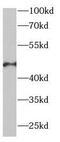 Eukaryotic Translation Initiation Factor 4A2 antibody, FNab02717, FineTest, Western Blot image 