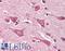 Myosin-Ib antibody, LS-B9534, Lifespan Biosciences, Immunohistochemistry paraffin image 