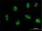 Exosome complex exonuclease RRP46 antibody, H00056915-M01, Novus Biologicals, Immunocytochemistry image 