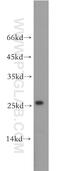 Coiled-Coil Domain Containing 25 antibody, 21209-1-AP, Proteintech Group, Western Blot image 