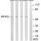 RAB11 Family Interacting Protein 2 antibody, A10249, Boster Biological Technology, Western Blot image 