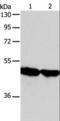 Arylacetamide Deacetylase antibody, LS-C401135, Lifespan Biosciences, Western Blot image 