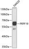 Pre-MRNA Processing Factor 19 antibody, 22-422, ProSci, Western Blot image 