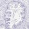 Tctex1 Domain Containing 4 antibody, HPA062652, Atlas Antibodies, Immunohistochemistry frozen image 
